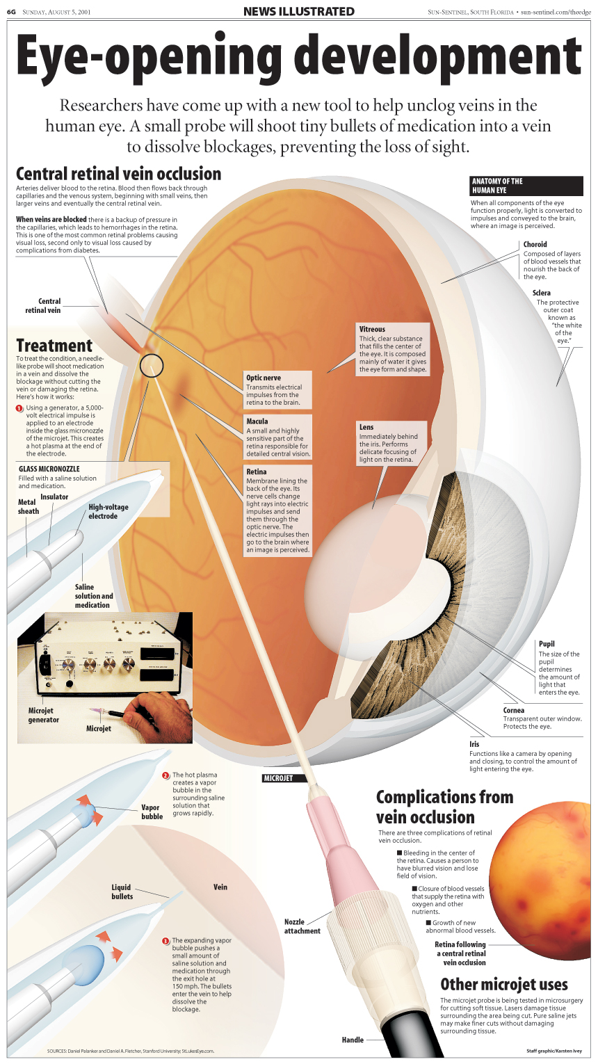 Eye opening development News Illustrated infographic