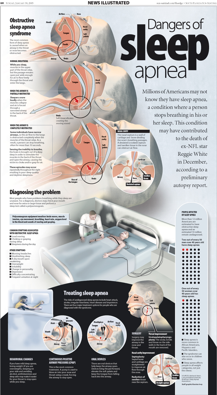 Sleep Apnea infographic