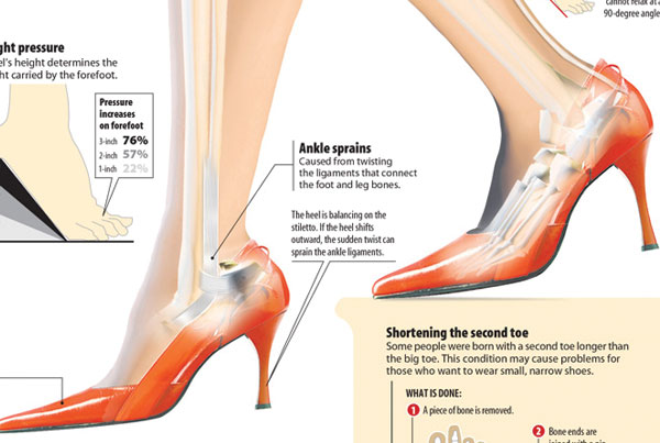High-Heel Hazards infographic