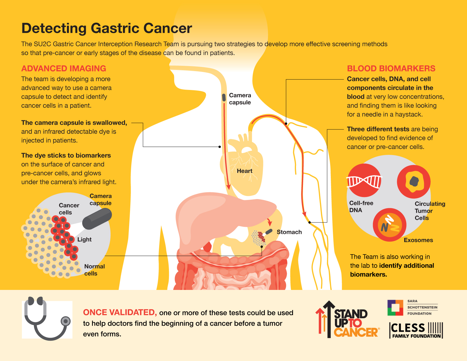 SU2C-GastricCancer-Infographic-FINAL-2