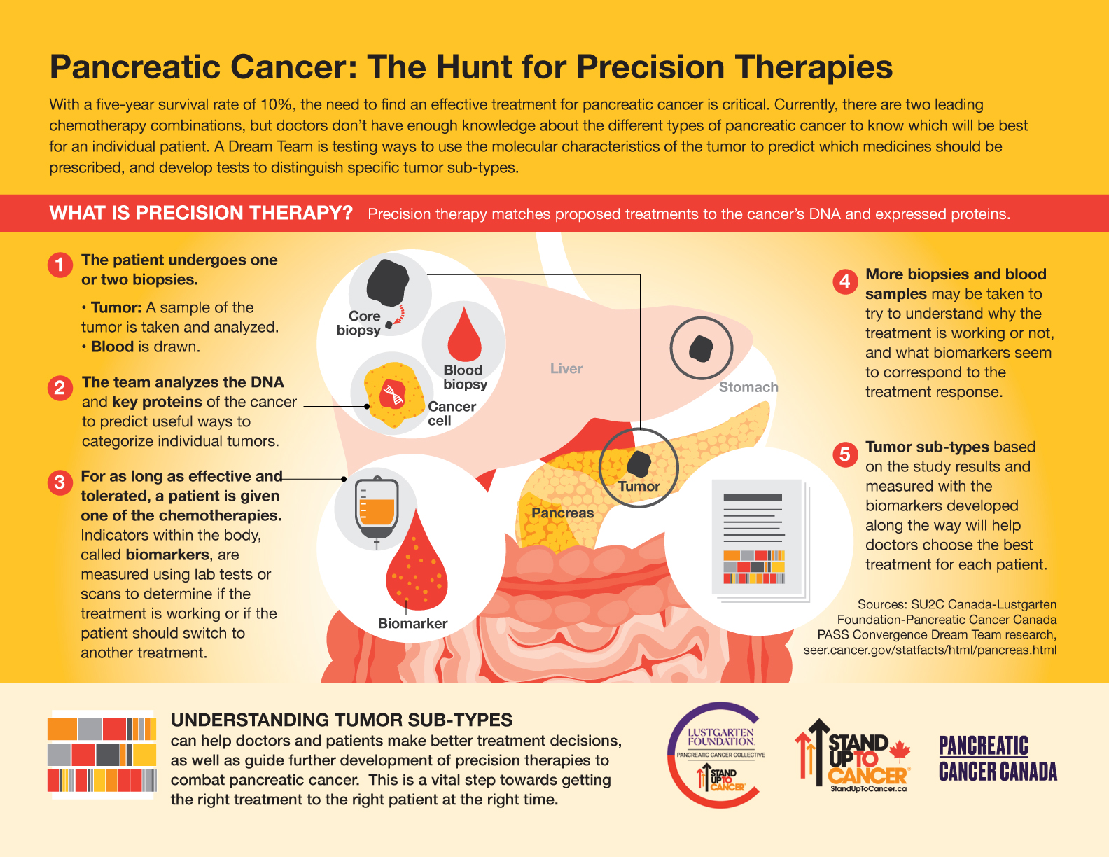 SU2C-PASS-Pancreatic-Cancer-Infographic-UPDATE